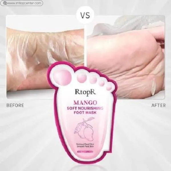 Rtopr Mango Soft Nourishing Foot Mask image 3