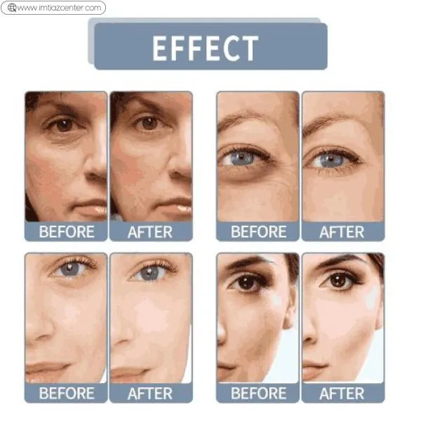 UPTOWN LA Niacinamide Serum image 2